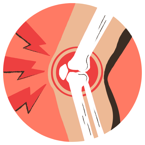 Knee Replacement Surgery in India